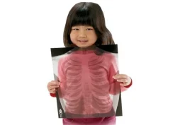 New Røntgenbilleder - Menneske, 18 stk