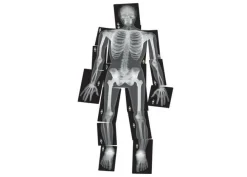 New Røntgenbilleder - Menneske, 18 stk