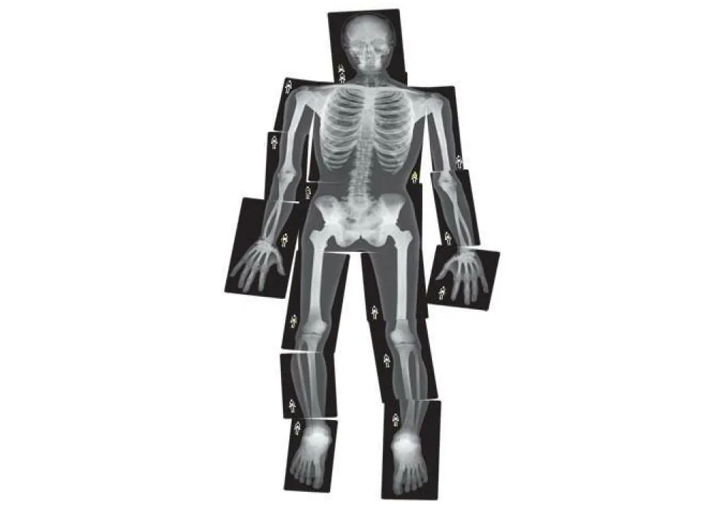 New Røntgenbilleder - Menneske, 18 stk