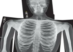 New Røntgenbilleder - Menneske, 18 stk