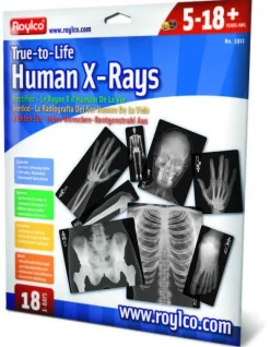 New Røntgenbilleder - Menneske, 18 stk