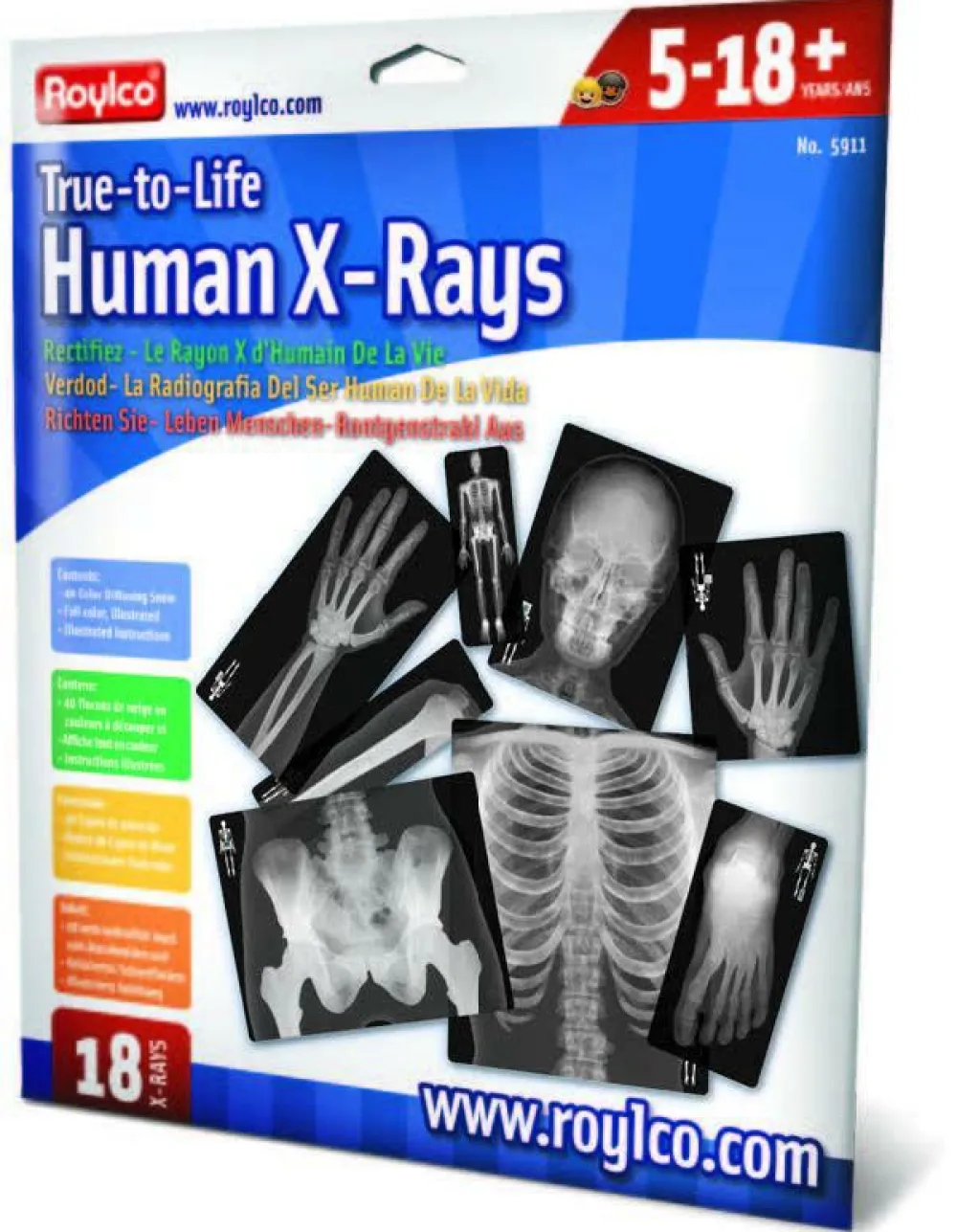New Røntgenbilleder - Menneske, 18 stk